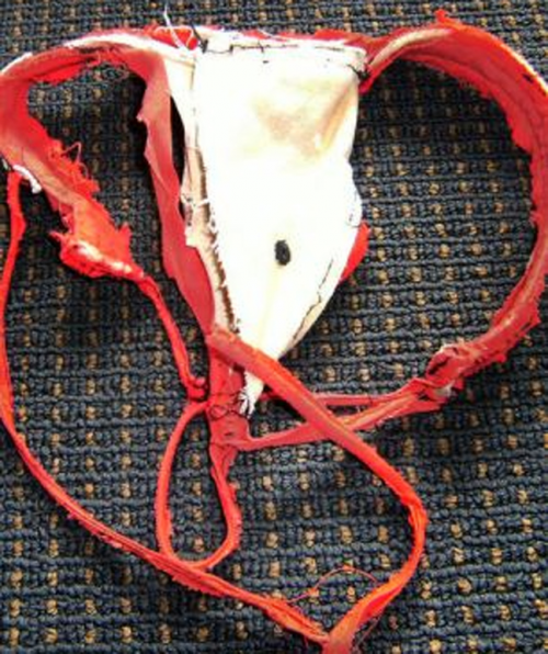 Στρινγκ μπλέχτηκε στο λαιμό φώκιας! - Φωτογραφία 3