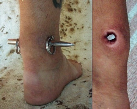 ΔΕΣ ΦΩΤΟ: Αποκρουστικά piercing σε απίθανα σημεία του σώματος! - Φωτογραφία 4