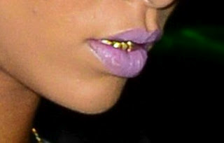 QUIZ: Ποιά γνωστή τραγουδίστρια εμφανίστηκε με χρυσά δόντια; - Φωτογραφία 1