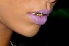 QUIZ: Ποιά γνωστή τραγουδίστρια εμφανίστηκε με χρυσά δόντια;