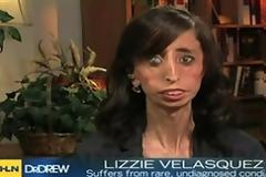 Η «ασχημότερη γυναίκα» με τη γενναία ψυχή