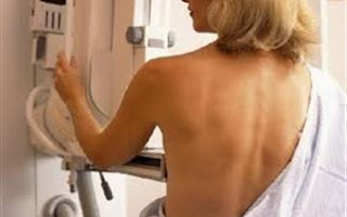 Ό,τι πρέπει να γνωρίζετε για τον καρκίνο του μαστού - Φωτογραφία 1
