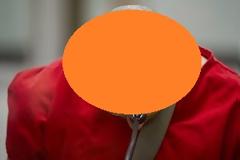 Φωτο - Σοκ: Δείτε πως είναι ο πιο τρομακτικός κακοποιός που σόκαρε ολόκληρο τον πλανήτη (pics)