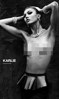 Περιοδικό «πάχυνε» μοντέλο για να μην φαίνονται τα κόκκαλά του(pic) - Φωτογραφία 3