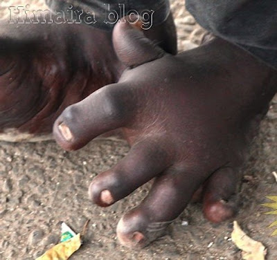 Ο άνθρωπος που είχε χέρια στα πόδια... - Φωτογραφία 4