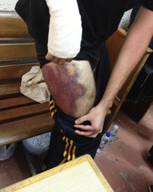 Guardian: «Βασανιστήρια» στη ΓΑΔΑ καταγγέλουν συλληφθέντες διαδηλωτές - Φωτογραφία 1