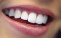 Όλα όσα πρέπει να ξέρετε για την λεύκανση δοντιών
