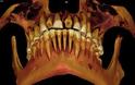 Το χειρότερο περιστατικό στην ιστορία της οδοντιατρικής