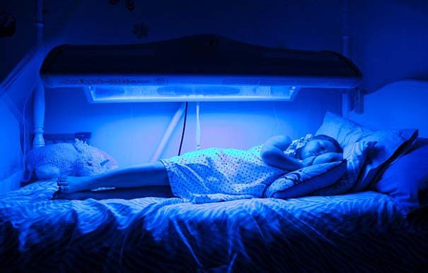 9χρονη πρέπει να κοιμάται κάτω από υπεριώδες φως κάθε βράδυ - Δείτε γιατί - Φωτογραφία 6