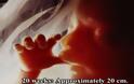 ΦΩΤΟ: Οι πρώτες 26 εβδομάδες ζωής του εμβρύου