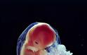 ΦΩΤΟ: Οι πρώτες 26 εβδομάδες ζωής του εμβρύου - Φωτογραφία 10