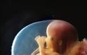 ΦΩΤΟ: Οι πρώτες 26 εβδομάδες ζωής του εμβρύου - Φωτογραφία 8