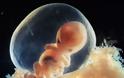 ΦΩΤΟ: Οι πρώτες 26 εβδομάδες ζωής του εμβρύου - Φωτογραφία 9