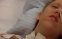 ΑΝΑΤΡΙΧΙΑΣΤΙΚΟ : 19χρονη ξύπνησε από κώμα την ώρα που θα της αφαιρούσαν τα όργανα - ΦΩΤΟ