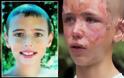 12χρονος Ήρωας: Πέρασε μέσα από πύρινη λαίλαπα για να σώσει τη γιαγιά του