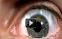 ΒΙΝΤΕΟ: Το ανθρώπινο μάτι σε αργή κίνηση