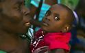 Aϊτή: Οι κυανόκρανοι του ΟΗΕ έφεραν τη χολέρα