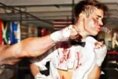 Έσπασαν στο ξύλο τον JUSTIN BIEBER (pics)