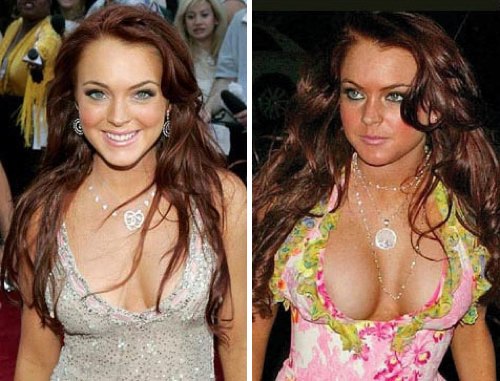 Ποιες διάσημες stars έχουν κάνει πλαστική στήθους; Δείτε photos πριν και μετά τη.. μεγέθυνση!! - Φωτογραφία 2