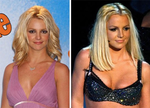 Ποιες διάσημες stars έχουν κάνει πλαστική στήθους; Δείτε photos πριν και μετά τη.. μεγέθυνση!! - Φωτογραφία 3
