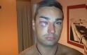 Νεοζηλανδός καταγγέλλει τον ξυλοδαρμό του από αστυνομικούς στην Κρήτη!