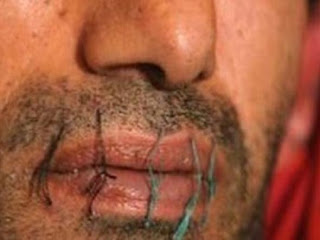 Αφγανός λαθρομετανάστης έραψε το στόμα του... Ζητά την άμεση απέλαση του, αλλά φαίνεται οι αρχές τους κρατάνε εδώ με το ζόρι!! - Φωτογραφία 1