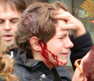 ΣΟΚ: Αστυνομικοί χτύπησαν 13χρονο στο κεφάλι στην Ισπανία- ΒΙΝΤΕΟ - Φωτογραφία 1