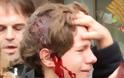ΣΟΚ: Αστυνομικοί χτύπησαν 13χρονο στο κεφάλι στην Ισπανία- ΒΙΝΤΕΟ