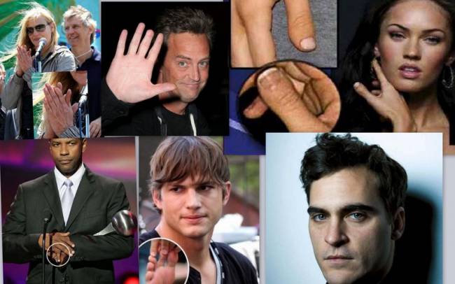 Οι φυσικές ατέλειες των σταρ του Χόλιγουντ: Έξι δάχτυλα, σιαμαίοι, κομμένα άκρα… - Φωτογραφία 1