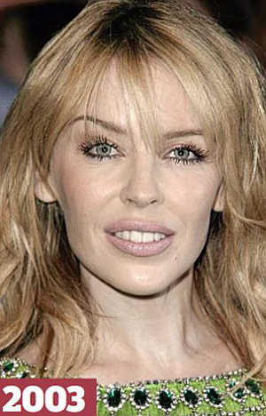 Οι κουπ της Kylie Minogue τα τελευταία 25 χρόνια!!! Σε ποιες περιπτώσεις θα έπρεπε να τα είχε ξυρίσει γουλί;;;; (PHOTOS) - Φωτογραφία 16