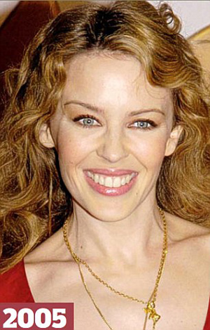 Οι κουπ της Kylie Minogue τα τελευταία 25 χρόνια!!! Σε ποιες περιπτώσεις θα έπρεπε να τα είχε ξυρίσει γουλί;;;; (PHOTOS) - Φωτογραφία 18