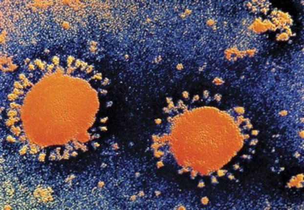 Νέα κρούσματα ιού που μοιάζει με το SARS στη Μέση Ανατολή, - Φωτογραφία 1
