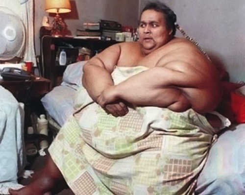 Οι 10 πιο παχύσαρκοι άνθρωποι στην ιστορία! - Φωτογραφία 8