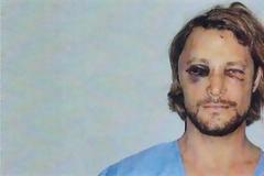 Σοκαριστικές φωτό: Τον «έσπασε στο ξύλο» ο Olivier Martinez τον πρώην της Halle Berry