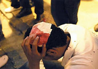 Νέα άγρια ρατσιστική επίθεση - Εξι άνδρες χτυπούσαν νεαρό Αιγύπτιο μέχρι να σωριαστεί - Φωτογραφία 1