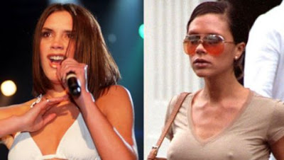 Αληθινά ή... σιλικόνη; (pics) - Φωτογραφία 1