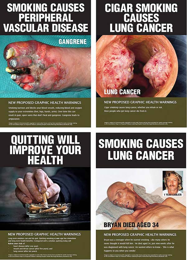 Αυστραλία: φρικτές εικόνες στα νέα πακέτα τσιγάρων - Φωτογραφία 4