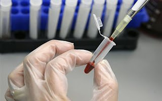 Αιματολογικό τεστ θα ανιχνεύει τον καρκίνο - Φωτογραφία 1