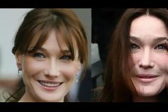 ΔΕΙΤΕ: Διάσημες που παραμορφώθηκαν εντελώς κυνηγώντας την ομορφιά!