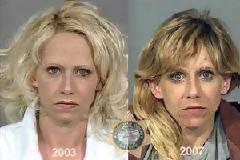 Άνθρωποι πριν και μετά την χρήση ναρκωτικών - Ανατριχιαστικές φωτό !