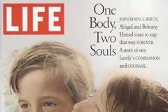 To κορίτσι με... τα 2 κεφάλια...!!! [photos]