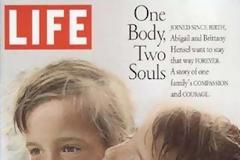 To κορίτσι με… τα 2 κεφάλια…!!! [φωτο]