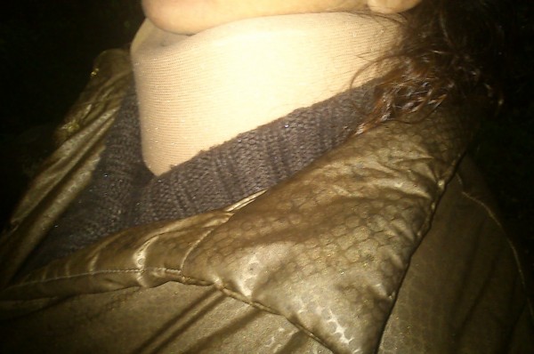 Ρόδος: Κινέζες δάγκωσαν Ελληνίδα γιατί... ζήτησε απόδειξη! ΦΩΤΟ & ΒΙΝΤΕΟ - Φωτογραφία 2