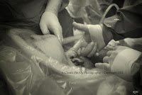 Μωρό αρπάζει το δάχτυλο γιατρού τη στιγμή της γέννησης του - Φωτογραφία 1