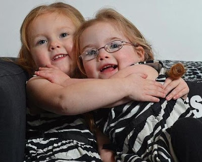 Η μία γεννήθηκε υγιής και η δίδυμη αδελφή της με σύνδρομο Down - Φωτογραφία 3