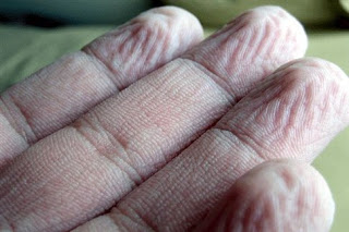 Γιατί τα ανθρώπινα δάχτυλα ζαρώνουν στο νερό - Φωτογραφία 1