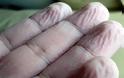 Γιατί τα ανθρώπινα δάχτυλα ζαρώνουν στο νερό