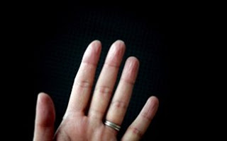 Εξηγήθηκε το «μυστήριο» των μουλιασμένων δαχτύλων - Φωτογραφία 1