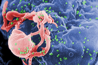 Έφτιαξαν με μοριακά ψαλίδια, κύτταρα ανθεκτικά στον HIV - Φωτογραφία 1