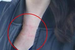 Πασίγνωστη ηθοποιός πήγε σε spa και βγήκε μες τις κοκκινίλες στο πρόσωπο και το στήθος!